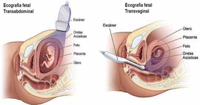 ecografía fetal